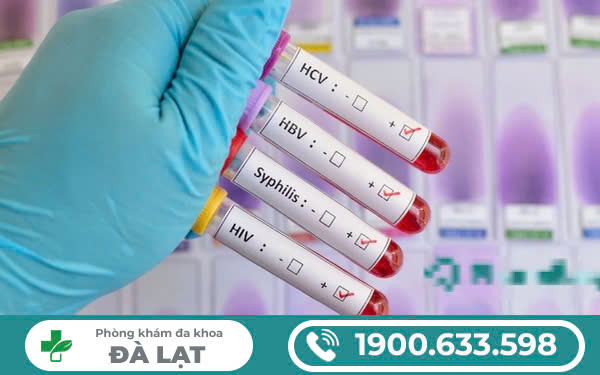 Hình ảnh minh họa